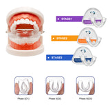 3Pcs Dental Braces Orthodontic Teeth Trainer Set for Adults Orthotics Tooth Retainers Alignment 3 Phases Teeth Straightener