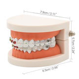 Dental Orthodontic Treatment Model With Ceramic Bracket Arch Wire Ortho Metal Orthodontic Toothed Denture Model