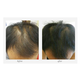 678nm Hair Growth Helmet Anti Hair Loss Device Treatment Anti Hair Loss Promote Hair Regrowth Cap Massage