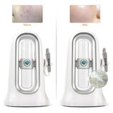 Peeling Machine Water Cycle Facial SPA Deep Cleansing Beauty Device Home Use Vacuum Blackhead Small Bubble Exfoliator