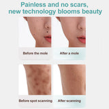 2021 Plasma Pen Skin Care Beauty Machine Mole Tattoo Freckle Wart Tag Dark Spot Skin Tag Remover Plazma Pen LCD Display