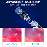 Otoscope With Light, 4.5Inch IPS Digital Video Otoscope, 3.9Mm Ear Camera With 6 Dimmable LED, Ear Wax Removal Camera