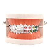 Dental Orthodontic Treatment Model With Ceramic Bracket Arch Wire Ortho Metal Orthodontic Toothed Denture Model
