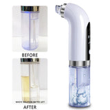 Blackhead Remover Vacuum Pore Cleaner Ultrasonic Skin Scrubber Face Cleaning Bubble Skin Cleaner Peeling Cavitation Face Lifting