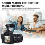 Portable Camera Microphone, Rabbit Hair Video Interview Microphone Directional Recording Shotgun Mic with Shock Mount for iPhone