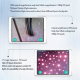 Wireless WiFi HD Scalp/Skin /Hair follicle Detector Skin UV Analyzer Skin Hair follicle Testing Examination Magnifying Analyzer