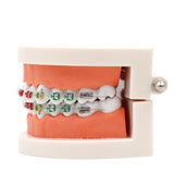 1pc Dental Orthodontic Treatment Model Typodont With Ortho Metal Ceramic Bracket Arch Wire Orthodontic Toothed Denture Model