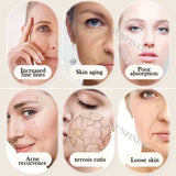 Needle Free EMS Mesotherapy Machine Nano RF Water Injection Anti-aging Wrinkles Device Skin Rejuvenation Facial Beauty Machine