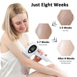 IPL Laser Hair Removal Device Safety Body Bikini Hair Trimmer Permanent Painless 990000 Flashes Smooth Skin Epilator depilador