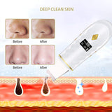 Electric Ultrasonic Face Skin Scrubber Face Cleaning Peeling Shovel Facial Pore Cleaner Blackhead Remover V Face Lifting Machine