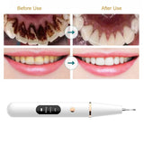 Dental Irrigator Dental Calculus Remover Electric Sonic Dental Scaler Tartar Removal Whitening Teeth Cleaner Oral Cleaning Tools