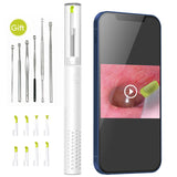 Wireless Otoscope Earwax Removal Camera, ScopeAround Digital Otoscope Ear Cleaner, 1080 HD Ear Camera with 6 LED Lights