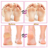 Pedicure Tools Professional Callus Removal Electric Foot Heel Care Tool Remove Dead Skin Feet Heels Cuticle Electronic Foot File