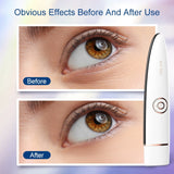 RF Beauty Device RF Lifting EMS Eye Massager Eye Bag Removal Face Firming Wrinkle Anti -Wrinkle Beauty Apparatus