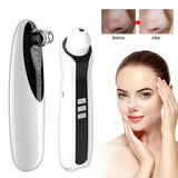 Visual Blackhead Remover Vacuum with Camera Vacuum Pore Cleanser Black Head Remover Deep Nose Pore Cleaner Acne Pimple Removal