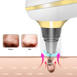 Blackhead Remover Deep Cleansing Blackhead Remover Vacuum Black Dot Pore Pimple Nose Acne Removal Facial Skin Care Beauty Tools