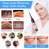 Sonic Dental Tartar Eliminator Scraper Scaler for Teeth Cleaning Whitening Electric Tooth Cleaner Dental Stone Removal Toothpick