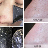 100pcs Bamboo Charcoal Blackhead Remover Mask Black Dots Spots Acne Treatment Mask Nose Sticker Cleaner Pore Deep Clean Strips