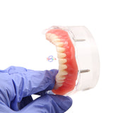 1pcs Dental Over denture Inferior Teeth Model With 2 Implant Demo Teeth Study Model Practical Dental Model Accessories