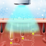 IPL Laser Hair Removal Ice Cooling Painless Laser Hair Epilator 6J Energy Permanent 990000 Flashed Whole Body Hair Remover