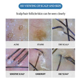Wireless APP WIFI Hair Follicles Scalp Detector Digital Skin Analyzer Microscope Tool High Definition Skin Tester Rechargeable