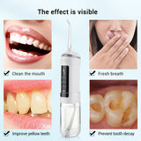 High Frequency Teeth Cleaner Plaque Tartar Remover Device Electric Dental Water Flusher Tongue Orthodontic Nozzle Oral Irrigator