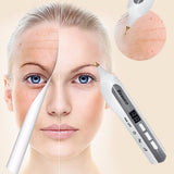 USB Beauty Device 3 Switchable Modes Laser Freckle Dot Mole Tattoo Removal Sweep Spot Pen Anti-Aging Skin Care Tool