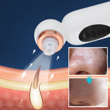 Small Bubble Blackhead Remover Vacuum Blue Light Sterilization Acne Suction Moisturizing Facial Pore Cleaner Beauty Extractor In