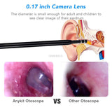 Medical In Ear Cleaning Endoscope Spoon Mini Camera Ear Picker Ear Wax Removal Visual Ear Mouth Nose Otoscope Support Android PC