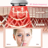 6in1 Face Massager EMS RF Infrared Multifunction Beauty Instrument Vibration Anti Aging Remover Wrinkle Firming Beauty Skincare