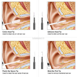 Medical In Ear Cleaning Endoscope Spoon Mini Camera Ear Picker Ear Wax Removal Visual Ear Mouth Nose Otoscope Support Android PC