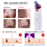 Face Blackhead Remover Vacuum Pore Ance Pimple Removal Cleaner Ultrasonic Skin Brush Cleaning Tool Suction Beauty For Women men