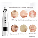 Electric Beauty Cleanser Vacuum Blackhead Remover Instrument Acne Pore Cleaning Multi-Functional Ultrasonic Facial Clean Device
