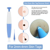 NEW Skin Tag Removal Kit Home Use Mole Wart Remover Microband Skin Tag Treatment Tool Easy To Clean Skin Care Tool