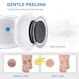 Callus Remover For Feet Electric Foot Scrubber  Pedicure Tool New Two Sand Heads For Dead Skin Calluses Dry And Cracked Skin