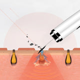 Ultrasonic Facial Skin Scrubber Ion Acne Blackhead Remover Peeling Shovel Cleaner Face Massager